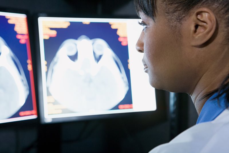 Tips for Recovering from a Concussion