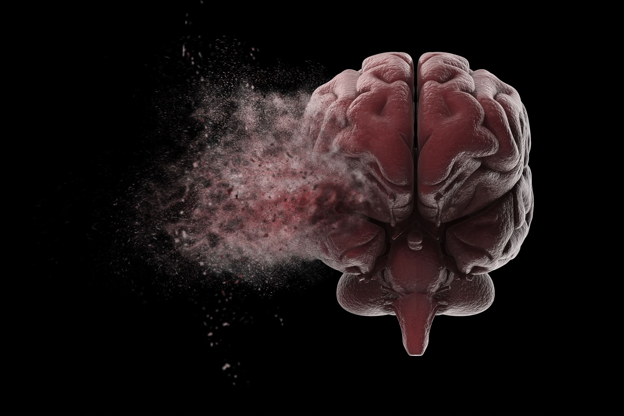 brain injury